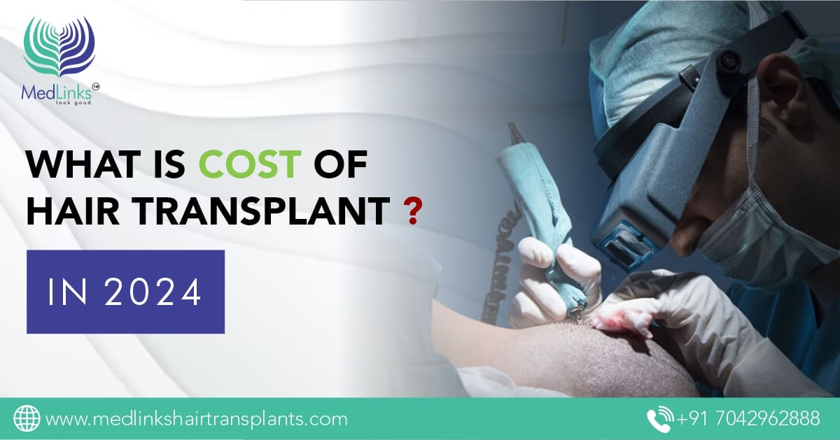 Hair Transplant Cost in India: MedLinks Guide